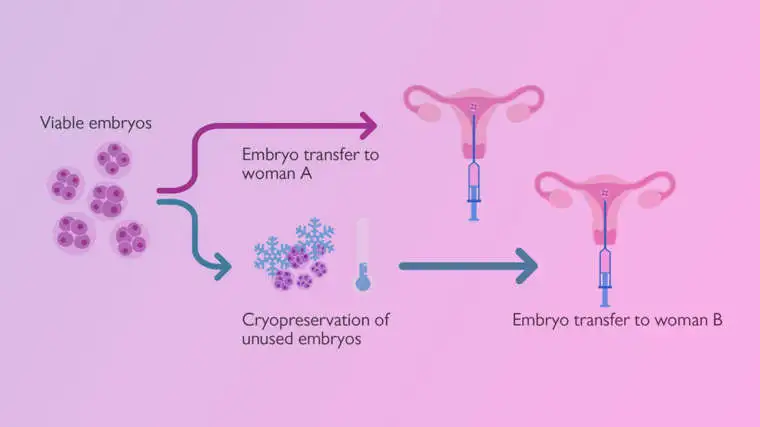 IVF with embryo donation