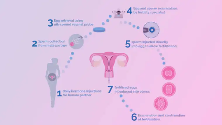 Intra Cytoplasmic Sperm Injection