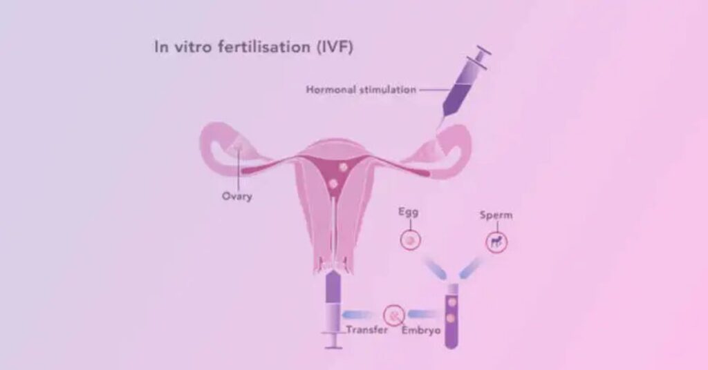 Best IVF Doctor in Kolkata | specialist, treatment, cost - Dr. Anindita Singh