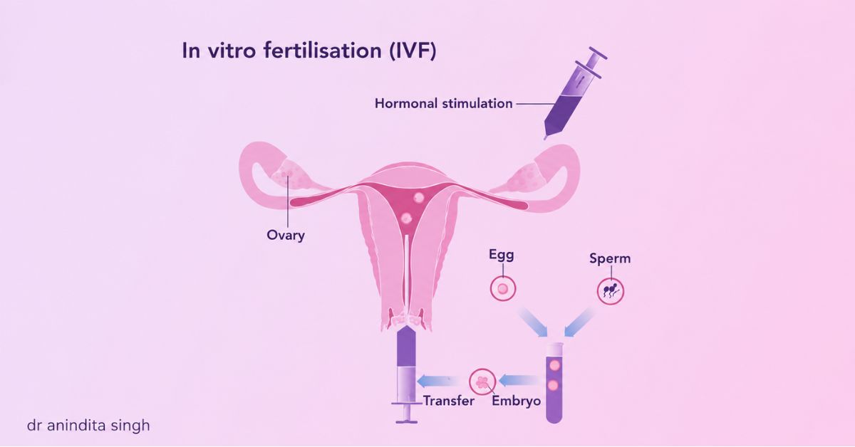 Best IVF Treatment in Kolkata